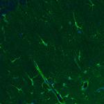 Glutamine Synthetase Monoclonal Antibody (CL2999)