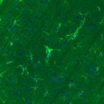 Glutamine Synthetase Antibody in Immunohistochemistry (Paraffin) (IHC (P))
