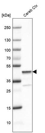 Glutamine Synthetase Antibody in Western Blot (WB)