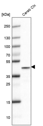 Glutamine Synthetase Antibody in Western Blot (WB)