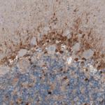 Glutamine Synthetase Antibody in Immunohistochemistry (Paraffin) (IHC (P))