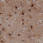 Glutamine Synthetase Antibody in Immunohistochemistry (Paraffin) (IHC (P))