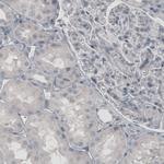 Glutamine Synthetase Antibody in Immunohistochemistry (Paraffin) (IHC (P))