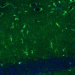 Glutamine Synthetase Antibody in Immunohistochemistry (Paraffin) (IHC (P))