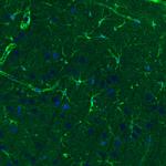 Glutamine Synthetase Antibody in Immunohistochemistry (Paraffin) (IHC (P))