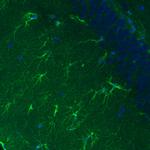 Glutamine Synthetase Antibody in Immunohistochemistry (Paraffin) (IHC (P))