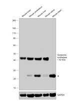 Glutamine Synthetase Antibody in Western Blot (WB)