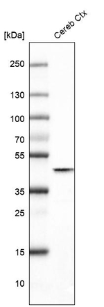 Glutamine Synthetase Antibody in Western Blot (WB)