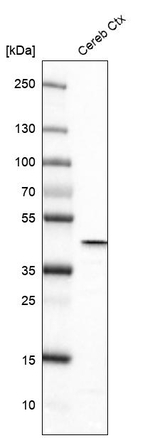 Glutamine Synthetase Antibody in Western Blot (WB)