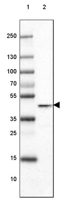 Glutamine Synthetase Antibody in Western Blot (WB)