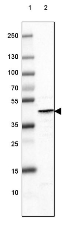 Glutamine Synthetase Antibody in Western Blot (WB)