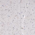 TPH2 Antibody in Immunohistochemistry (Paraffin) (IHC (P))