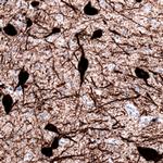 TPH2 Antibody in Immunohistochemistry (Paraffin) (IHC (P))
