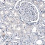 TPH2 Antibody in Immunohistochemistry (Paraffin) (IHC (P))