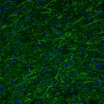 TPH2 Antibody in Immunohistochemistry (Paraffin) (IHC (P))