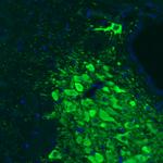 Tyrosine Hydroxylase Antibody in Immunohistochemistry (Paraffin) (IHC (P))