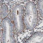 Laminin gamma-1 Antibody in Immunohistochemistry (Paraffin) (IHC (P))
