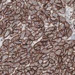 Laminin gamma-1 Antibody in Immunohistochemistry (Paraffin) (IHC (P))