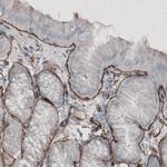 Laminin gamma-1 Antibody in Immunohistochemistry (Paraffin) (IHC (P))
