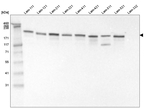 Laminin gamma-1 Antibody in Western Blot (WB)