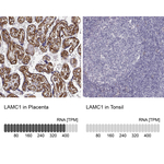 Laminin gamma-1 Antibody in Immunohistochemistry (Paraffin) (IHC (P))