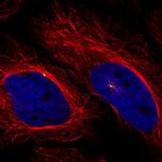 CDK5RAP2 Antibody in Immunocytochemistry (ICC/IF)
