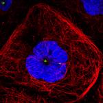 CDK5RAP2 Monoclonal Antibody (CL3392)