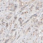 CDK5RAP2 Antibody in Immunohistochemistry (Paraffin) (IHC (P))