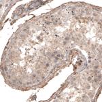 CDK5RAP2 Antibody in Immunohistochemistry (Paraffin) (IHC (P))