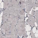 CD142 Monoclonal Antibody (CL3807)