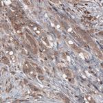 B-Raf Antibody in Immunohistochemistry (Paraffin) (IHC (P))