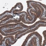 B-Raf Antibody in Immunohistochemistry (Paraffin) (IHC (P))