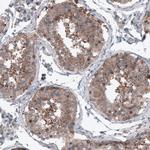 B-Raf Antibody in Immunohistochemistry (Paraffin) (IHC (P))