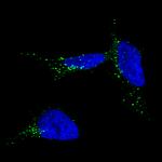 TYRP1 Monoclonal Antibody (CL4906)