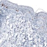 TYRP1 Antibody in Immunohistochemistry (Paraffin) (IHC (P))