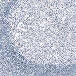 TYRP1 Antibody in Immunohistochemistry (Paraffin) (IHC (P))