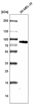 TYRP1 Antibody in Western Blot (WB)