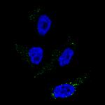 TYRP1 Monoclonal Antibody (CL4923)