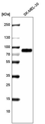 TYRP1 Antibody in Western Blot (WB)