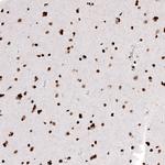 HIST1H2AG Antibody in Immunohistochemistry (Paraffin) (IHC (P))