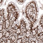 HIST1H2AG Antibody in Immunohistochemistry (Paraffin) (IHC (P))
