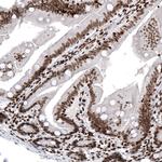 HIST1H2AG Antibody in Immunohistochemistry (Paraffin) (IHC (P))