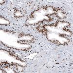 HIST1H2AG Antibody in Immunohistochemistry (Paraffin) (IHC (P))