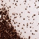 Histone H2A.X Antibody in Immunohistochemistry (Paraffin) (IHC (P))