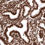 Histone H2A.X Antibody in Immunohistochemistry (Paraffin) (IHC (P))