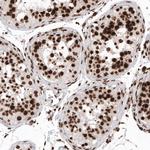 Histone H2A.X Antibody in Immunohistochemistry (Paraffin) (IHC (P))