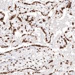 KLF4 Antibody in Immunohistochemistry (Paraffin) (IHC (P))