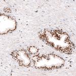 KLF4 Antibody in Immunohistochemistry (Paraffin) (IHC (P))