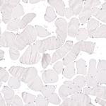 KLF4 Antibody in Immunohistochemistry (Paraffin) (IHC (P))