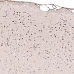 POU3F2 Antibody in Immunohistochemistry (Paraffin) (IHC (P))